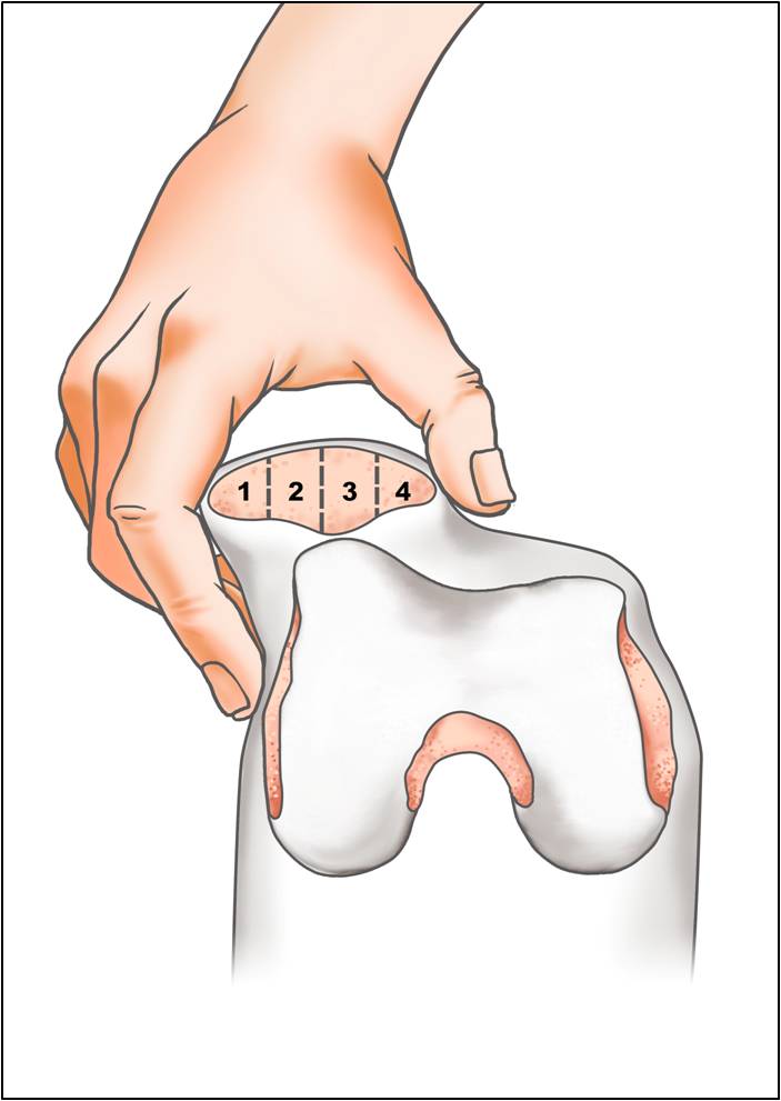 Knee Doctor Articles Asia Medical Specialists